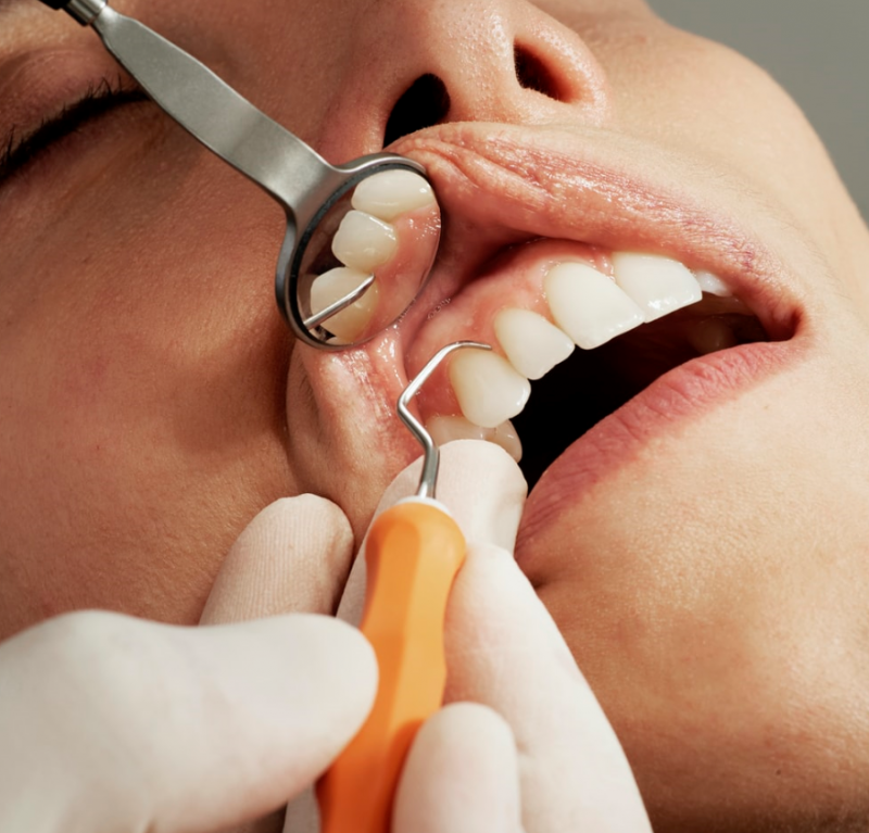 Clarus dentalni center - Infodent